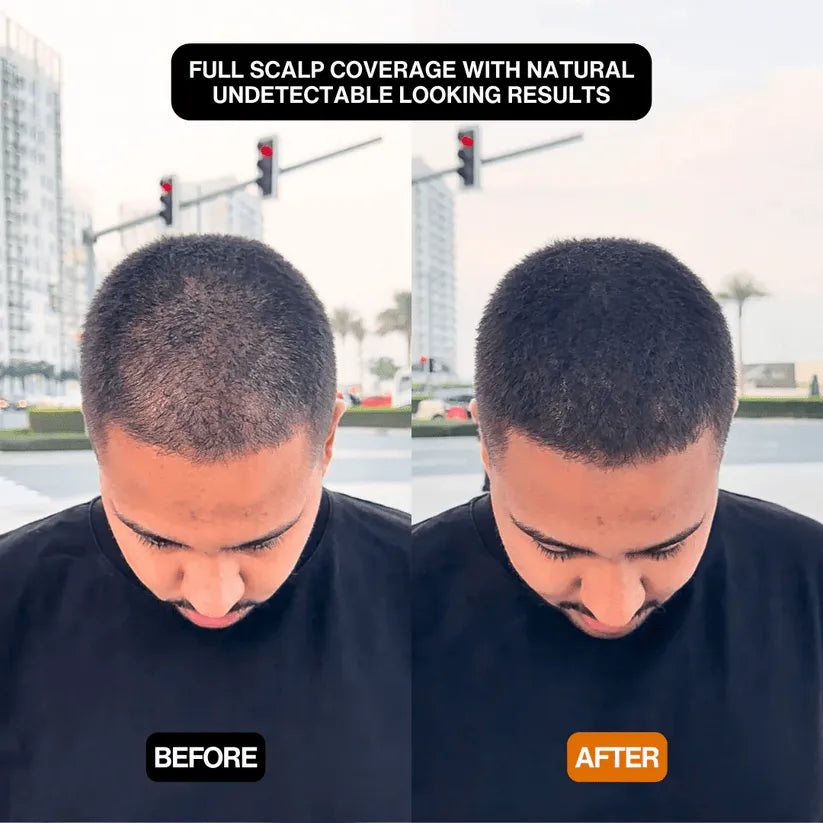 FitalFlex™ #1 Hair Filling Powder