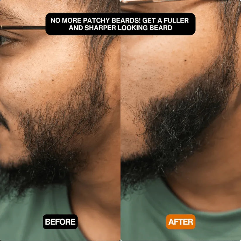 FitalFlex™ #1 Hair Filling Powder