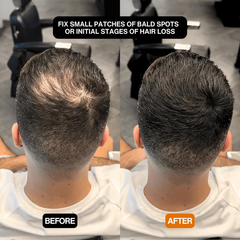 FitalFlex™ #1 Hair Filling Powder