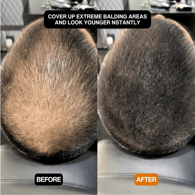 FitalFlex™ #1 Hair Filling Powder