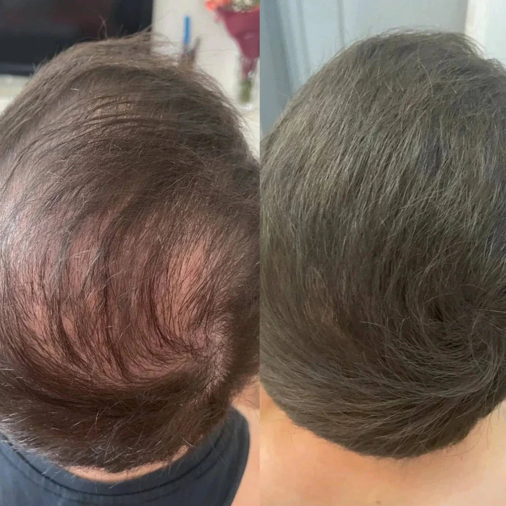 FitalFlex™ Hair Powder