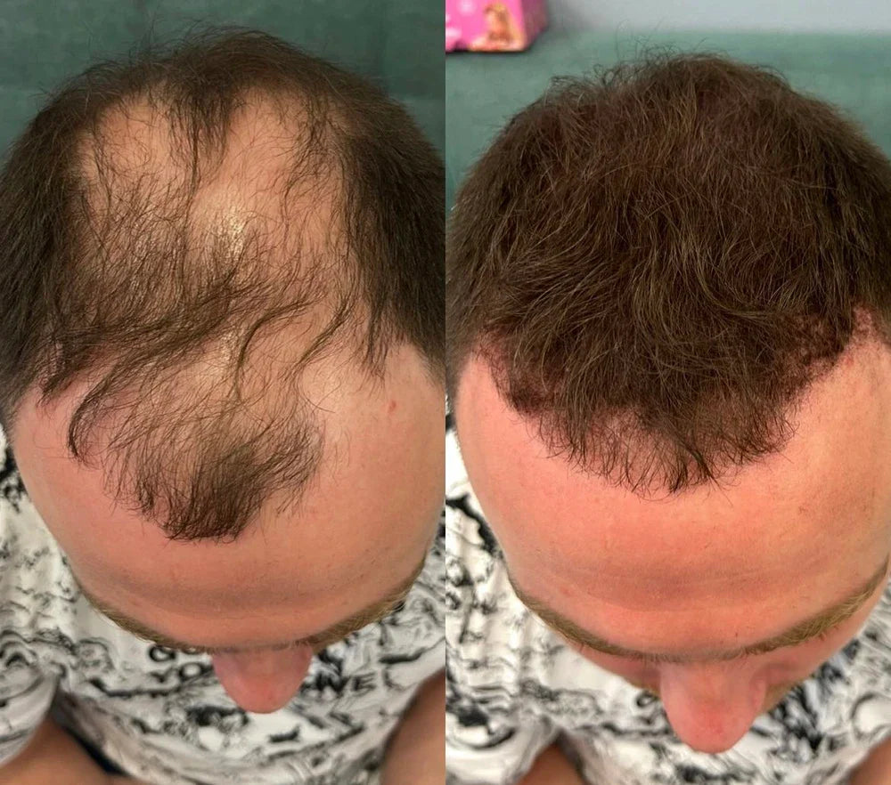 FitalFlex™ Hair Powder