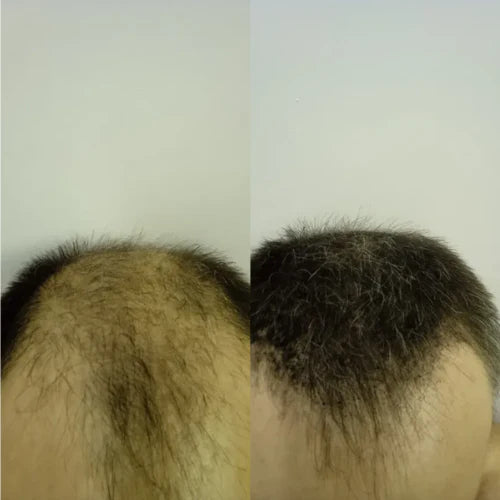 FitalFlex™ Hair Powder