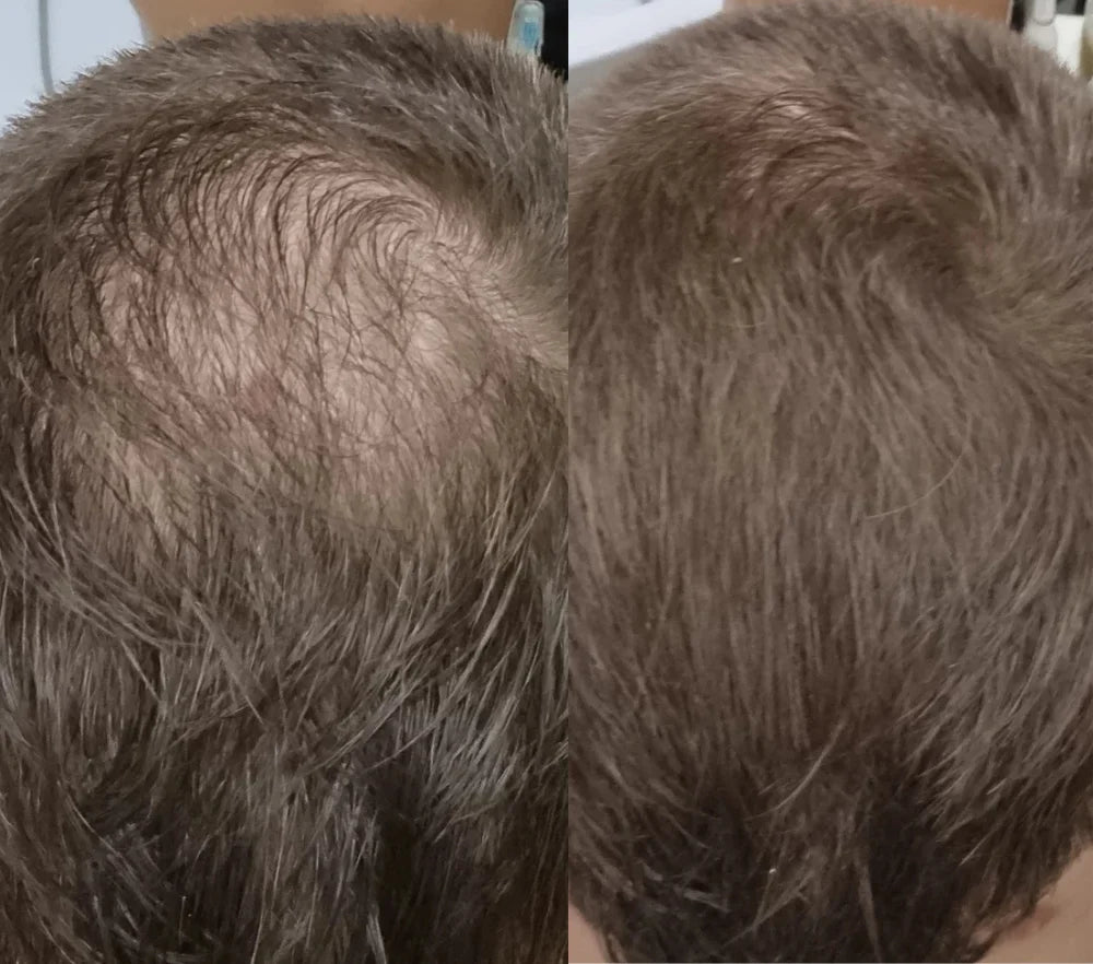 FitalFlex™ Hair Powder