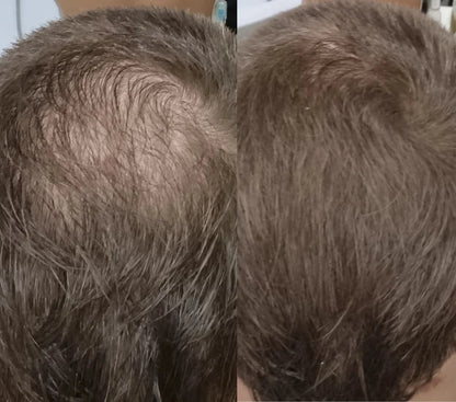 FitalFlex™ Hair Powder