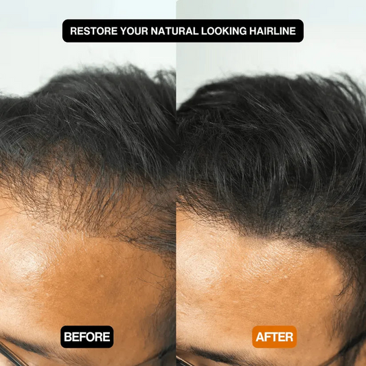 FitalFlex™ #1 Hair Filling Powder