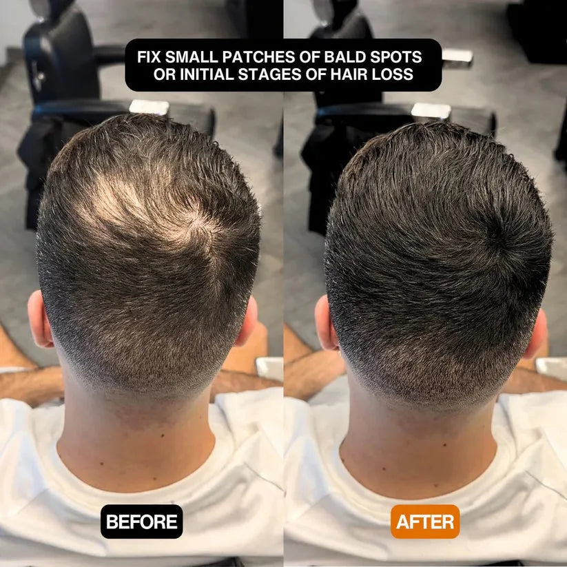 FitalFlex™ #1 Hair Filling Powder