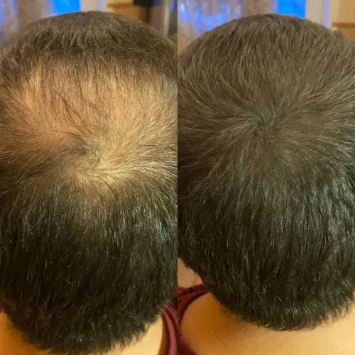 FitalFlex™ Hair Powder