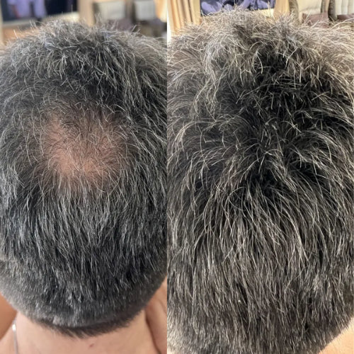 FitalFlex™ Hair Powder