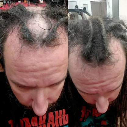 FitalFlex™ Hair Powder