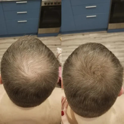 FitalFlex™ Hair Powder