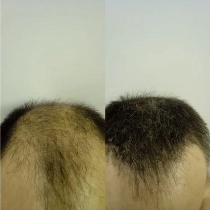 FitalFlex™ Hair Powder